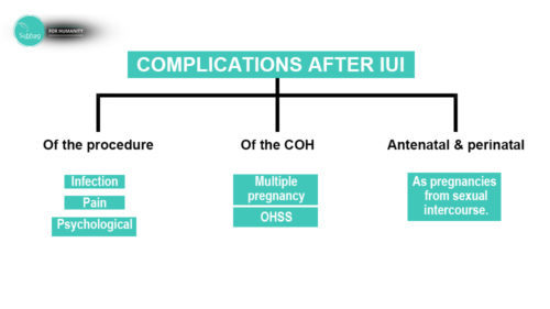 IUI process