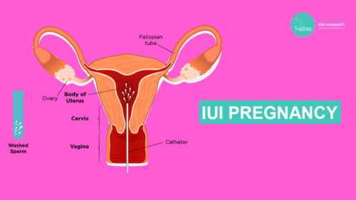 IUI PREGNANCY