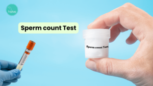 Sperm count Test