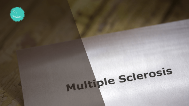 Understanding Multiple Sclerosis Causes and Prevention